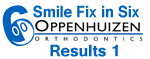 Smile-Fix-in-Six-logo-2-results-1