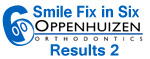Smile-Fix-in-Six-logo-2-results-2